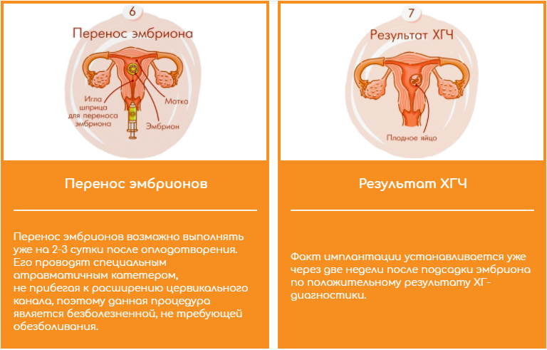 Перенос эмбриона и оценка результатов ХГЧ это завершающие этапы ЭКО levels 4.png