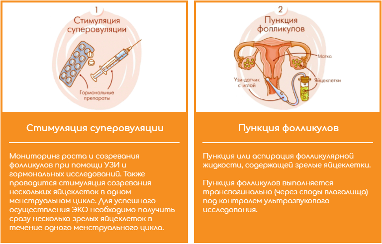 Этапы ЭКО Этапы ЭКО
